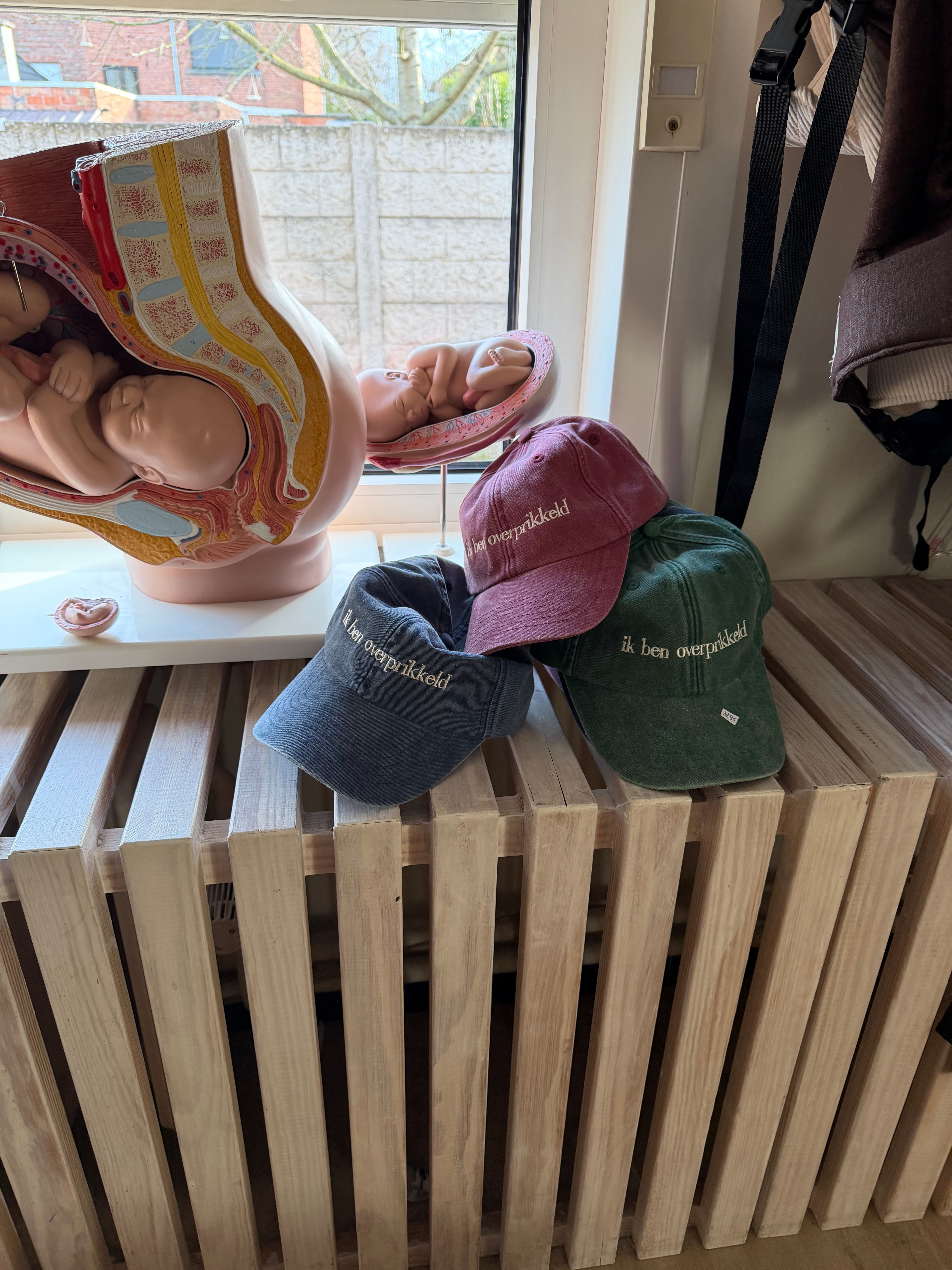 Pet 'ik ben overprikkeld'