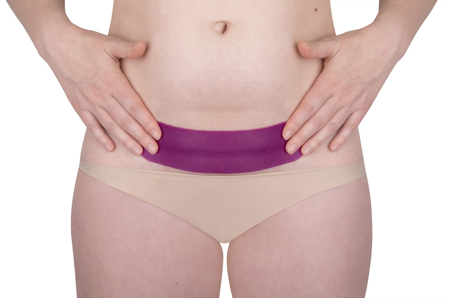 Scarban C-Section siliconenpleister voor littekens na keizersnede