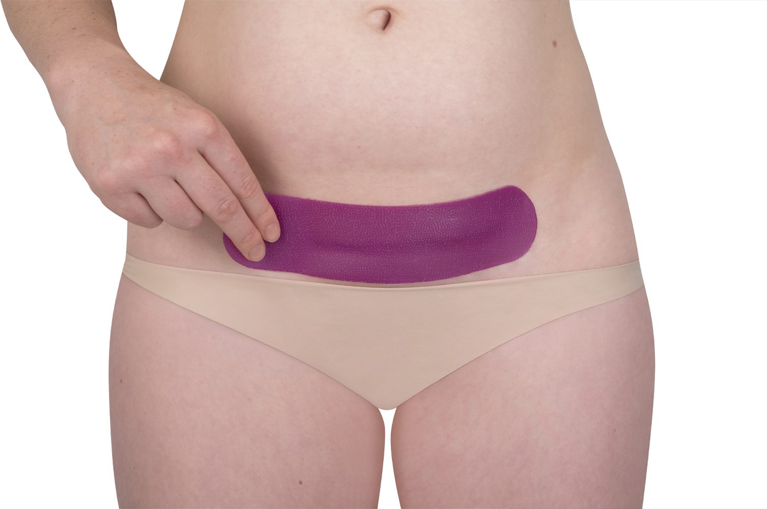 Scarban C-Section siliconenpleister voor littekens na keizersnede