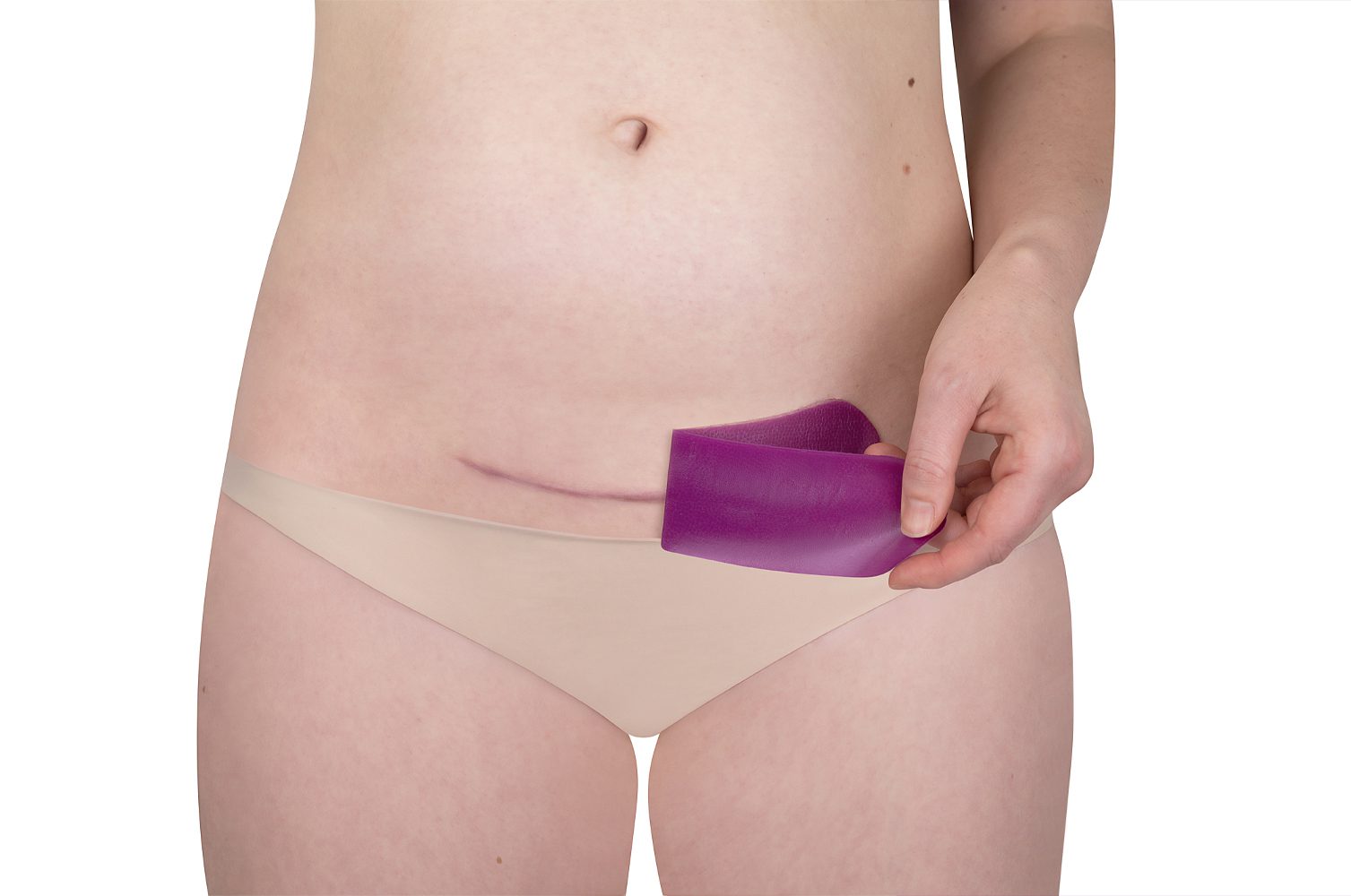 Scarban C-Section siliconenpleister voor littekens na keizersnede