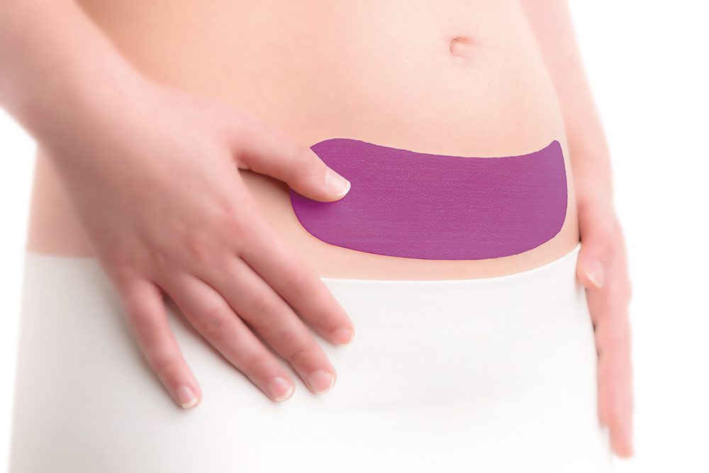 Scarban C-Section siliconenpleister voor littekens na keizersnede