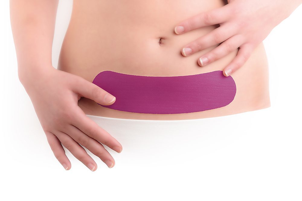 Scarban C-Section siliconenpleister voor littekens na keizersnede